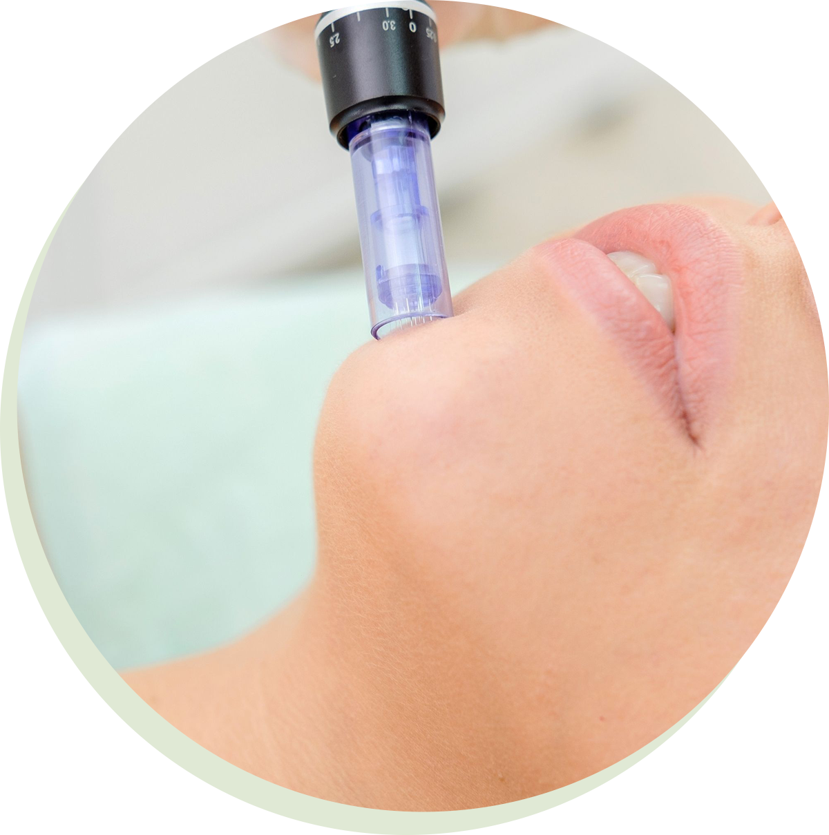 Microneedling-Safe-Effective