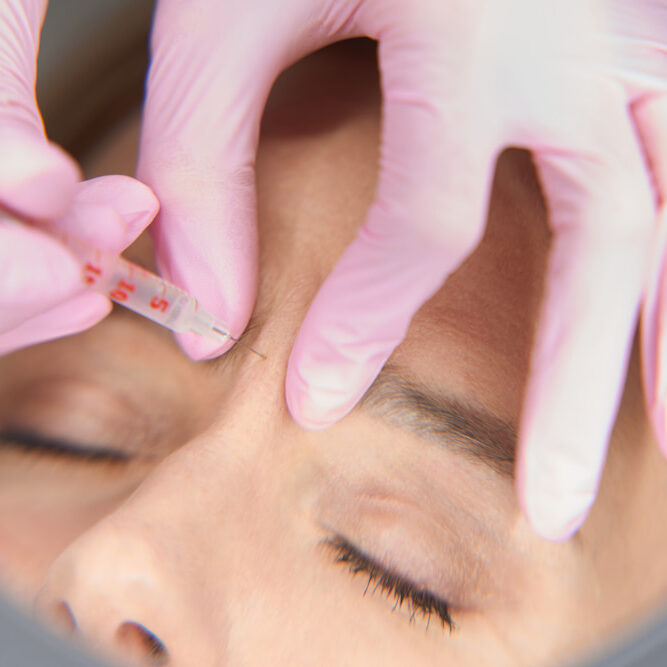 Botox for wrinkles