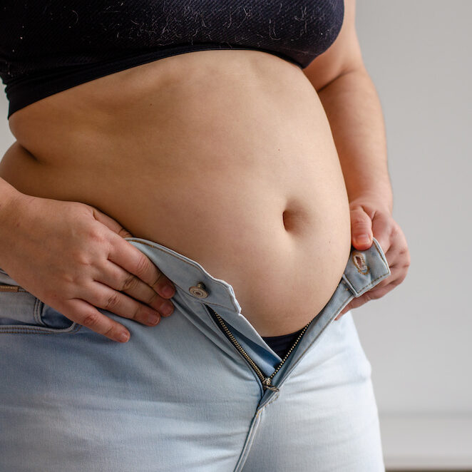 CoolSculpting for belly fat