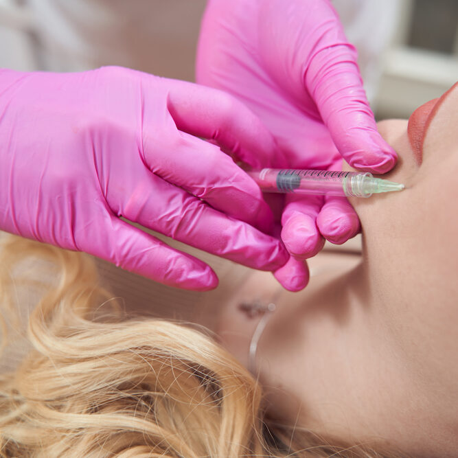 Dermal filler injections