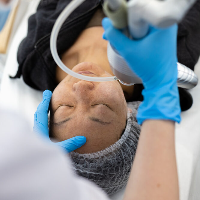 HydraFacial for Dry Skin