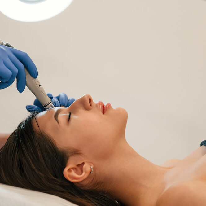 HydraFacial for dry skin